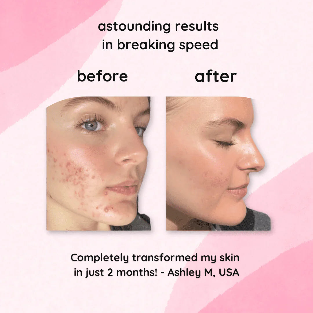 Aurests Turmeric & Kojic Acid Pads | 40 Pack